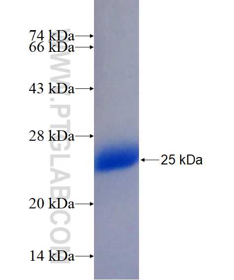 BTG4 fusion protein Ag14501 SDS-PAGE