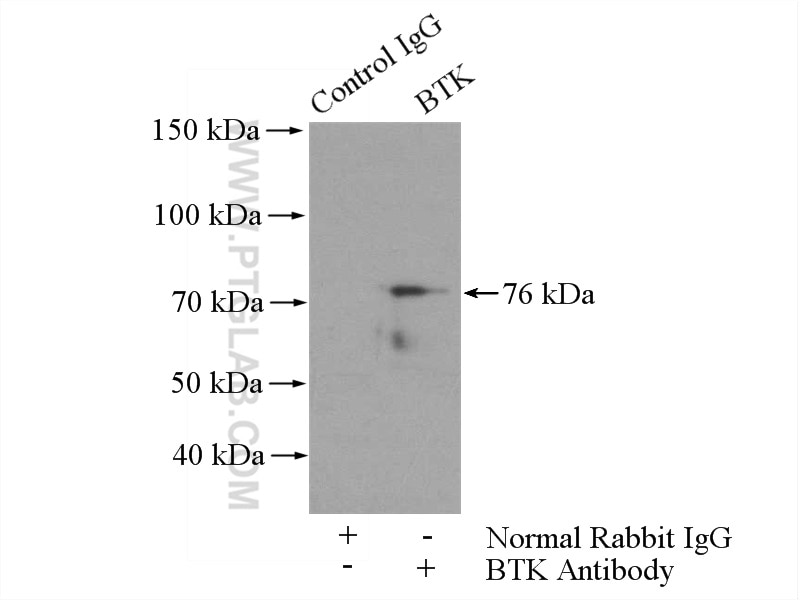 Immunoprecipitation (IP) experiment of mouse spleen tissue using BTK Polyclonal antibody (21581-1-AP)
