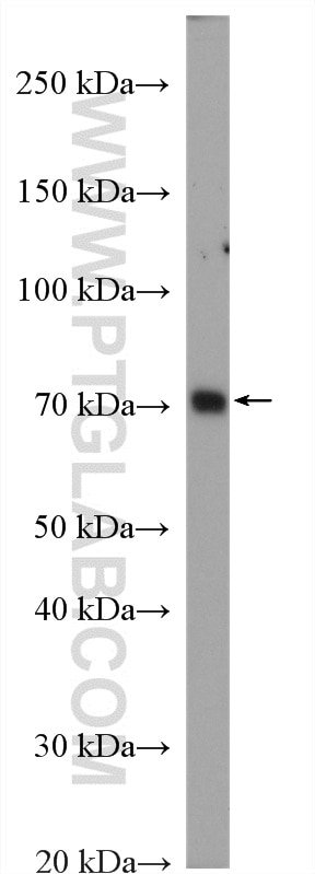Western Blot (WB) analysis of Daudi cells using BTK Polyclonal antibody (21581-1-AP)