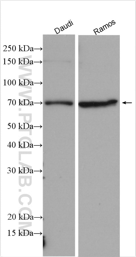 Western Blot (WB) analysis of various lysates using BTK Polyclonal antibody (21581-1-AP)