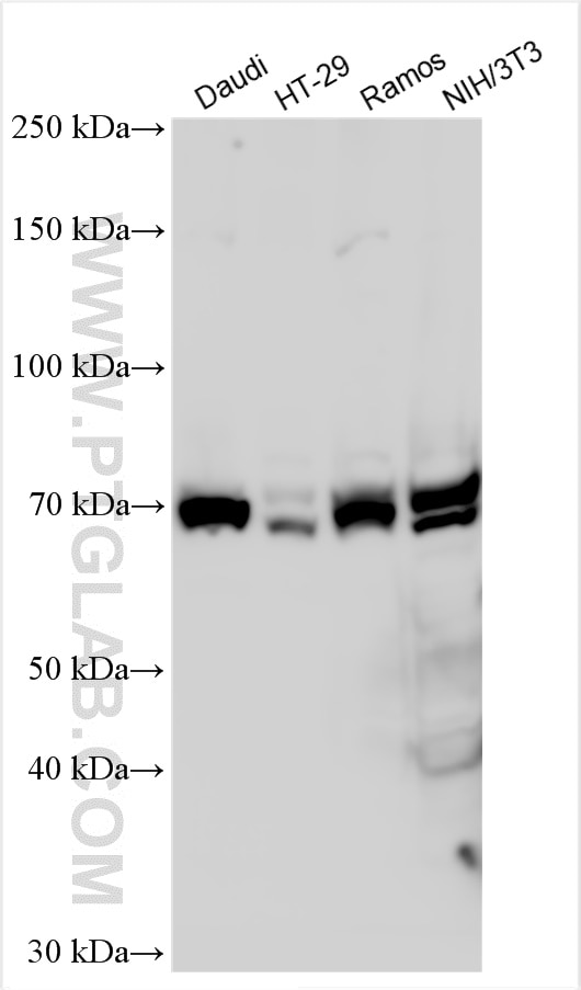 Western Blot (WB) analysis of various lysates using BTK Polyclonal antibody (21581-1-AP)