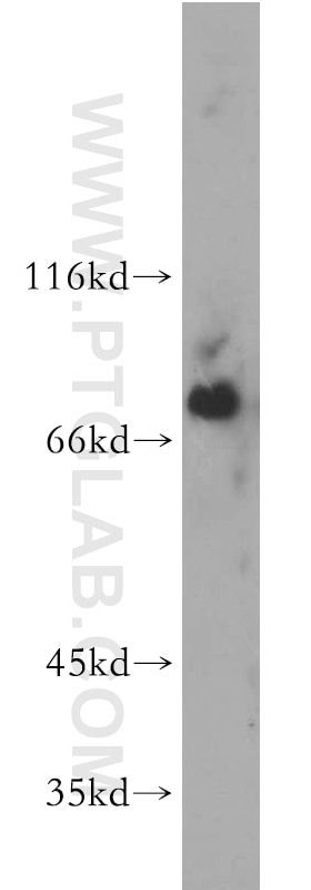 BTK Polyclonal antibody
