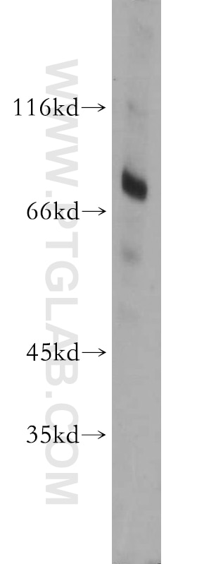 Western Blot (WB) analysis of L02 cells using BTK Polyclonal antibody (21581-1-AP)