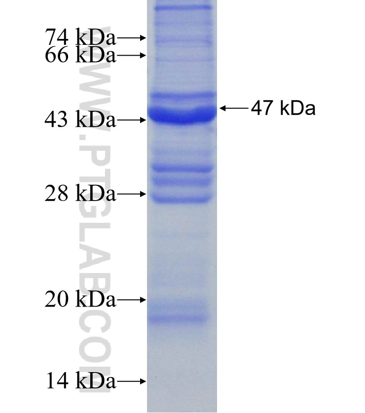 BTK fusion protein Ag16133 SDS-PAGE