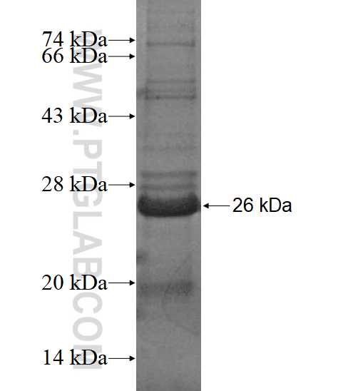 BTK fusion protein Ag17088 SDS-PAGE