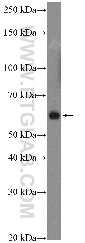 Western Blot (WB) analysis of Raji cells using BTLA Polyclonal antibody (21300-1-AP)