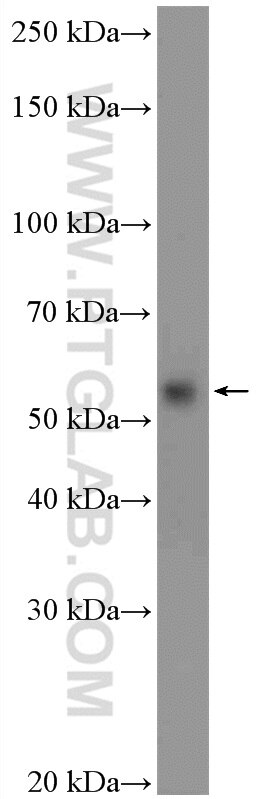 Western Blot (WB) analysis of Jurkat cells using BTLA Polyclonal antibody (21300-1-AP)