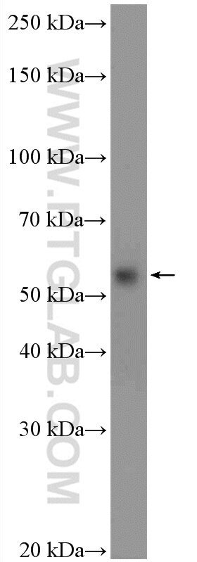 WB analysis of Jurkat using 21300-1-AP