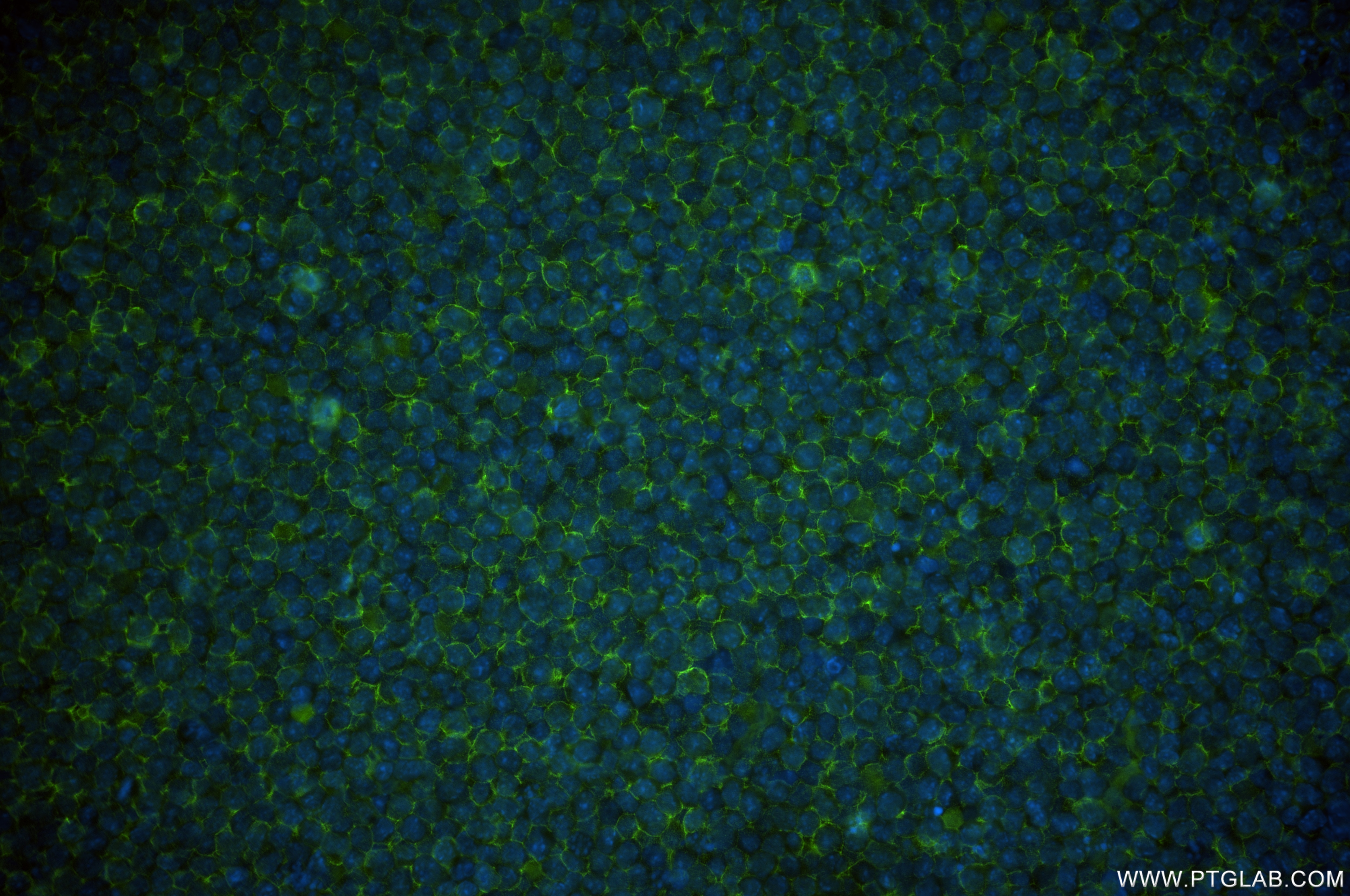 Immunofluorescence (IF) / fluorescent staining of A20 cells using BTLA Recombinant antibody (84754-5-RR)
