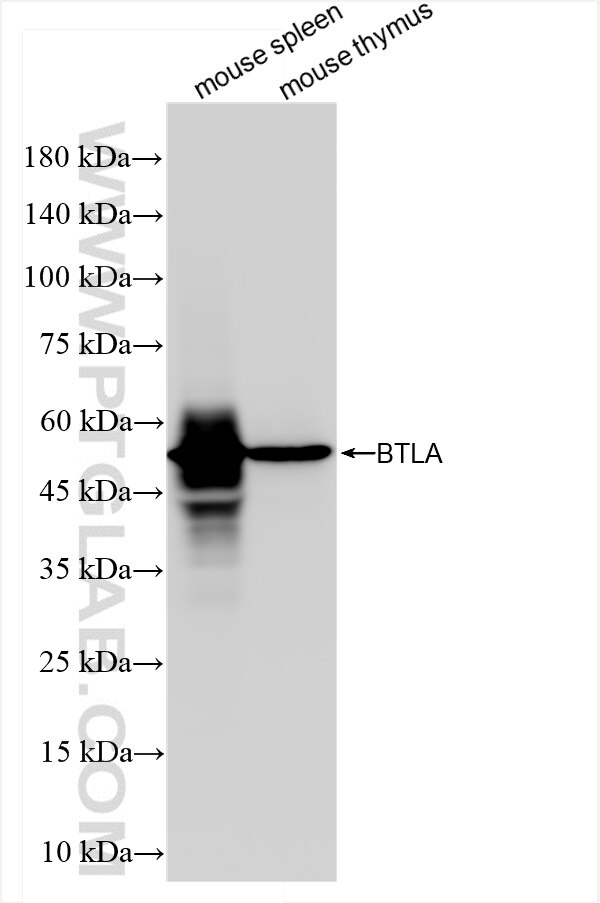 Western Blot (WB) analysis of various lysates using BTLA Recombinant antibody (84754-5-RR)