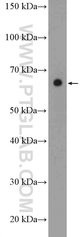 Western Blot (WB) analysis of rat spleen tissue using BTN2A1 Polyclonal antibody (20596-1-AP)