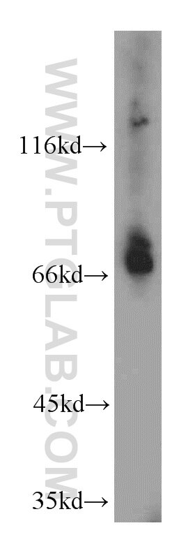 Western Blot (WB) analysis of HeLa cells using BTN2A1 Polyclonal antibody (20596-1-AP)