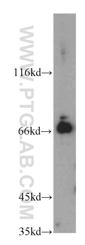 Western Blot (WB) analysis of MCF-7 cells using BTN2A1 Polyclonal antibody (20596-1-AP)