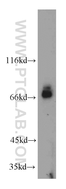Western Blot (WB) analysis of Jurkat cells using BTN2A1 Polyclonal antibody (20596-1-AP)