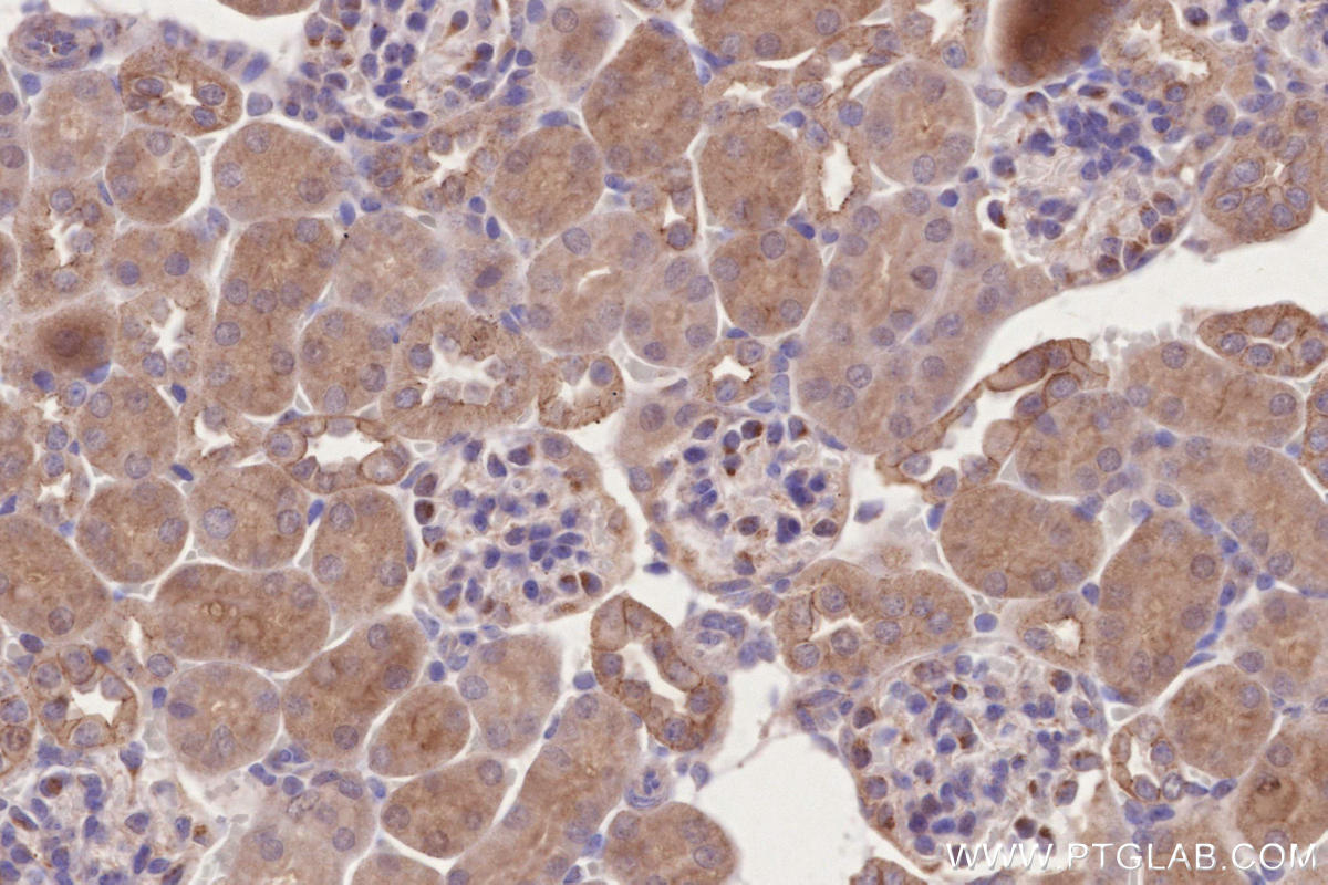 Immunohistochemistry (IHC) staining of mouse kidney tissue using BTN2A2 Polyclonal antibody (16482-1-AP)