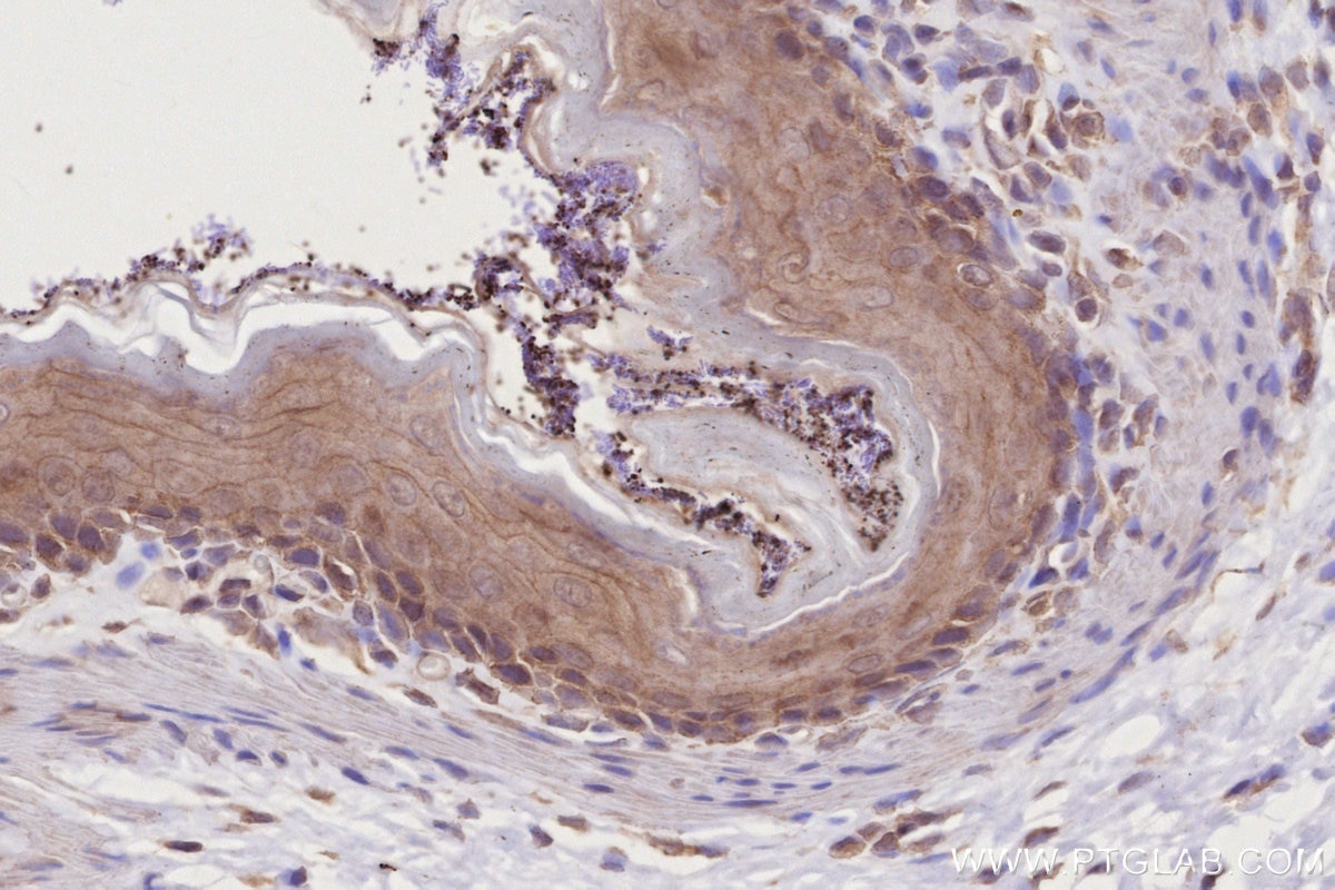 Immunohistochemistry (IHC) staining of rat stomach tissue using BTN2A2 Polyclonal antibody (16482-1-AP)