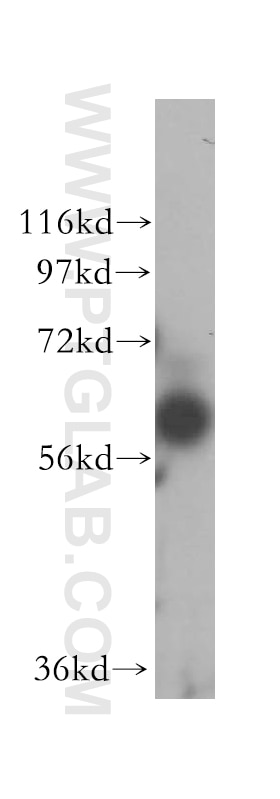 Western Blot (WB) analysis of MCF-7 cells using BTN2A2 Polyclonal antibody (16482-1-AP)