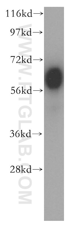 Western Blot (WB) analysis of human testis tissue using BTN2A2 Polyclonal antibody (16482-1-AP)