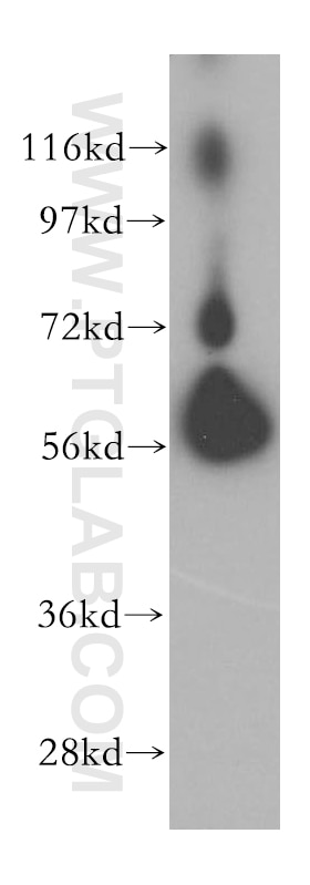 Western Blot (WB) analysis of NIH/3T3 cells using BTN2A2 Polyclonal antibody (16482-1-AP)