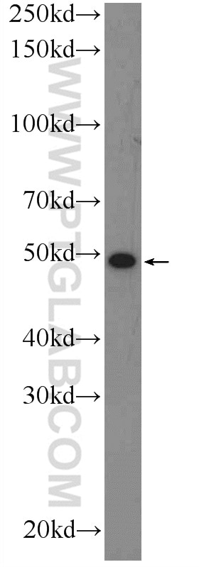 WB analysis of Jurkat using 25221-1-AP