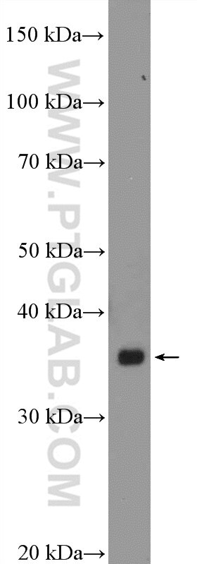 Western Blot (WB) analysis of SKOV-3 cells using BTN3A2 Polyclonal antibody (15148-1-AP)