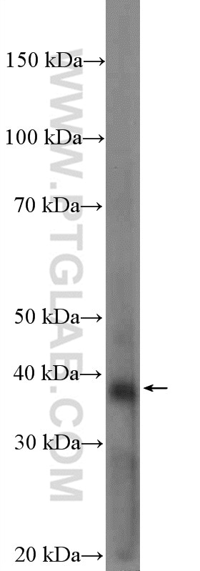 Western Blot (WB) analysis of SKOV-3 cells using BTN3A2 Polyclonal antibody (15148-1-AP)