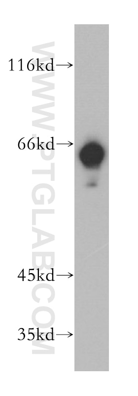 Western Blot (WB) analysis of Jurkat cells using BTN3A3 Polyclonal antibody (15896-1-AP)