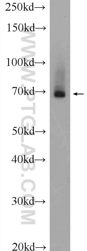 Western Blot (WB) analysis of mouse kidney tissue using BTNL2 Polyclonal antibody (25110-1-AP)