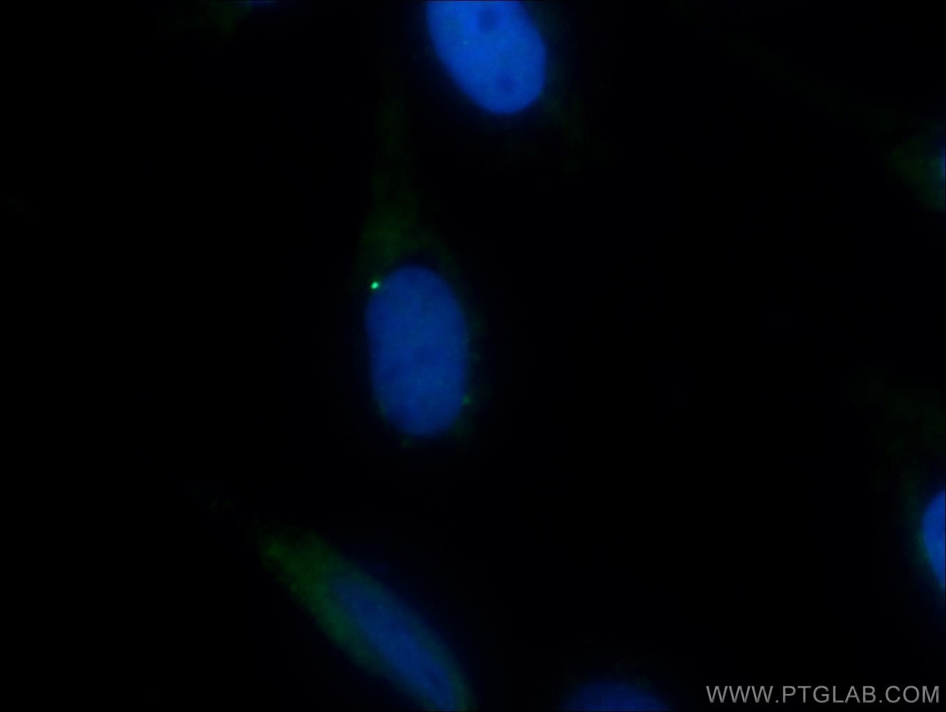 IF Staining of MDCK using 13330-1-AP