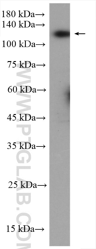 Western Blot (WB) analysis of MKN-45 cells using BUB1 Polyclonal antibody (13330-1-AP)