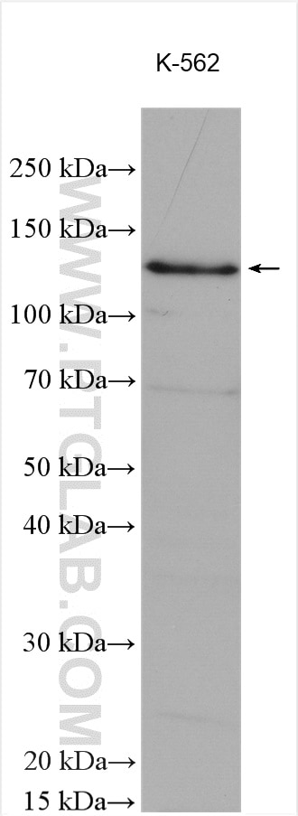 Western Blot (WB) analysis of various lysates using BUB1 Polyclonal antibody (13330-1-AP)