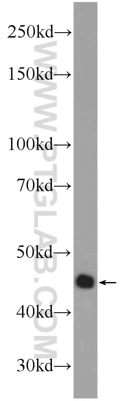 WB analysis of HeLa using 13330-1-AP