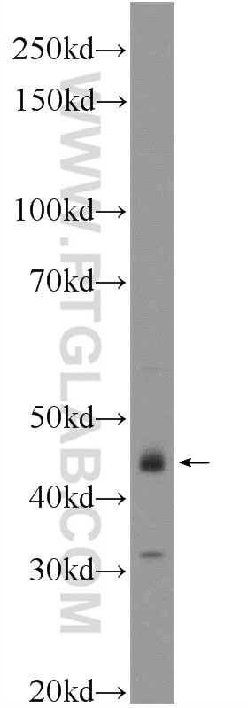 Western Blot (WB) analysis of SGC-7901 cells using BUB1 Polyclonal antibody (13330-1-AP)
