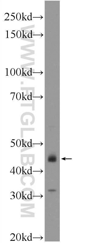 WB analysis of SGC-7901 using 13330-1-AP