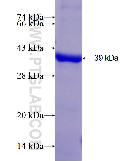 BUB1 fusion protein Ag28564 SDS-PAGE