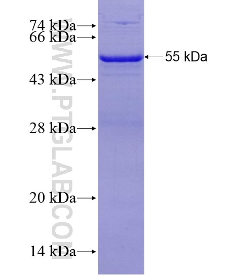 BUB1 fusion protein Ag28916 SDS-PAGE