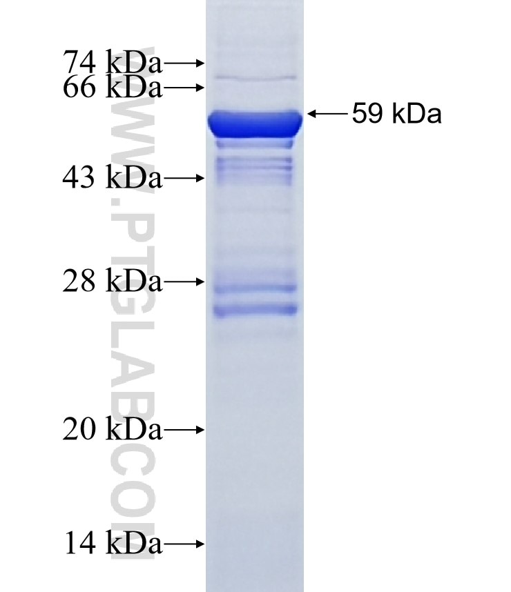 BUB1 fusion protein Ag4138 SDS-PAGE