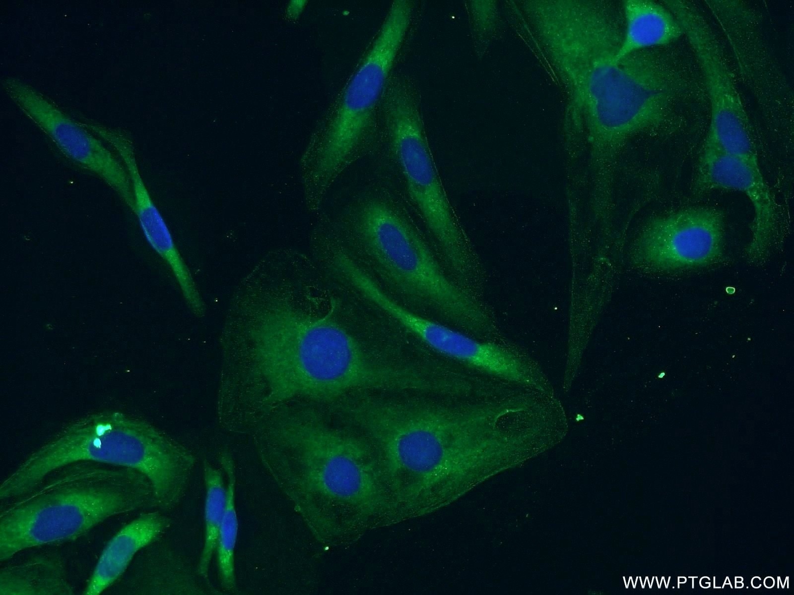 Immunofluorescence (IF) / fluorescent staining of SKOV-3 cells using BubR1 Polyclonal antibody (11504-2-AP)
