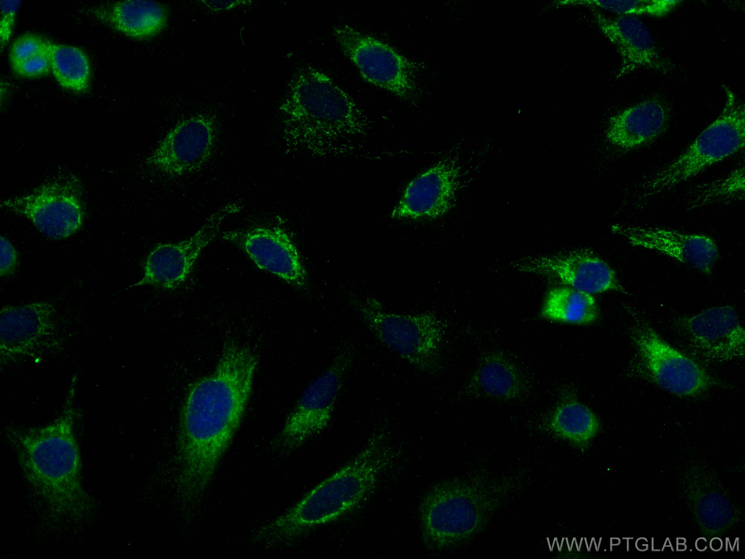 Immunofluorescence (IF) / fluorescent staining of SKOV-3 cells using BubR1 Polyclonal antibody (11504-2-AP)