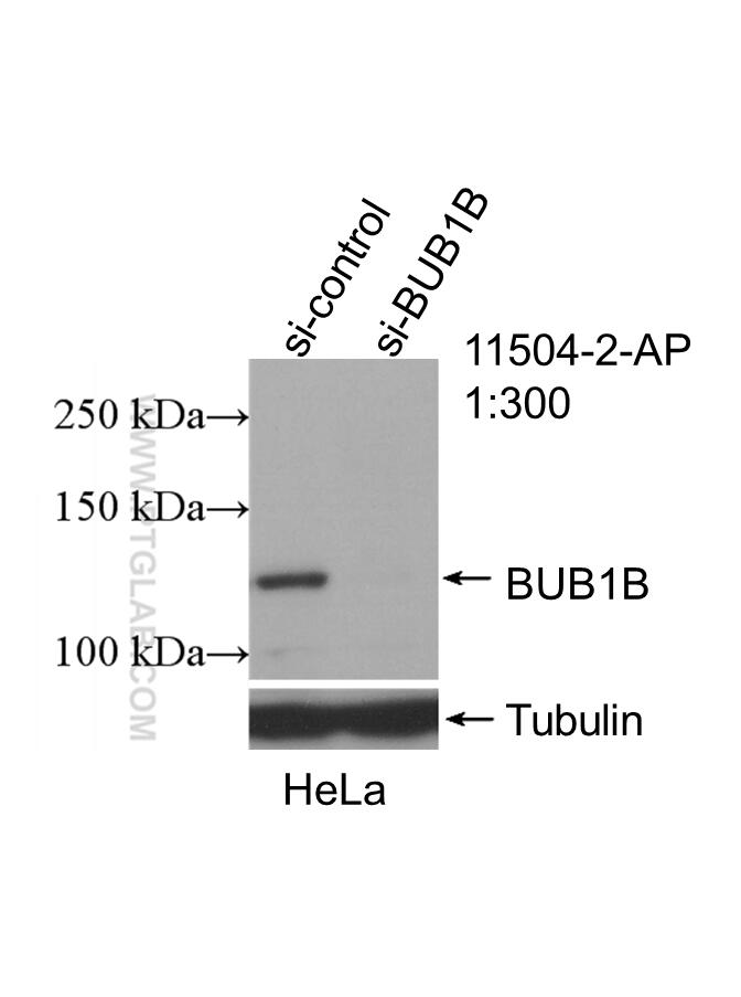 Western Blot (WB) analysis of HeLa cells using BubR1 Polyclonal antibody (11504-2-AP)