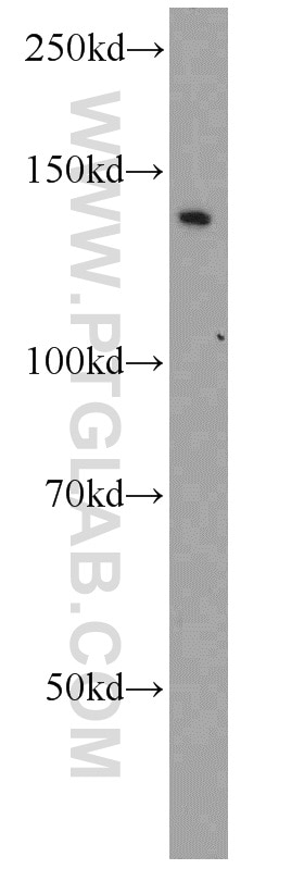 Western Blot (WB) analysis of mouse testis tissue using BubR1 Polyclonal antibody (11504-2-AP)