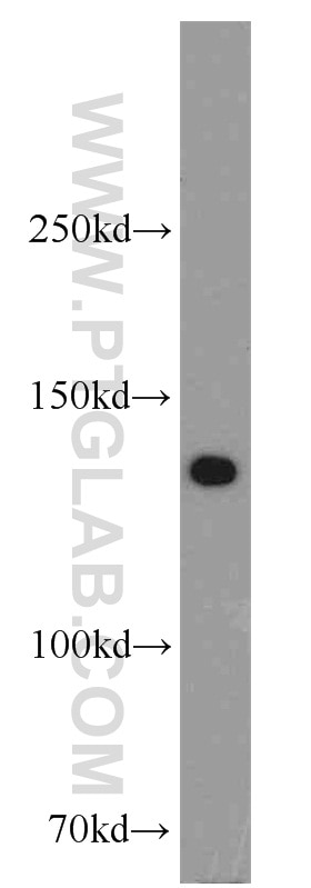 Western Blot (WB) analysis of mouse testis tissue using BubR1 Polyclonal antibody (11504-2-AP)