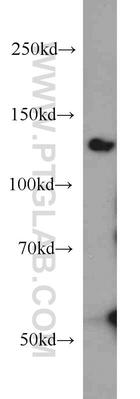 Western Blot (WB) analysis of human testis tissue using BubR1 Polyclonal antibody (11504-2-AP)