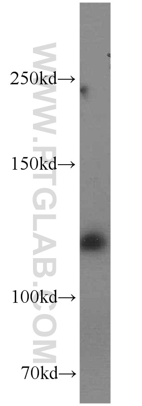 Western Blot (WB) analysis of K-562 cells using BubR1 Polyclonal antibody (11504-2-AP)