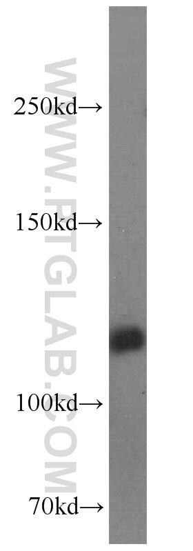 Western Blot (WB) analysis of HeLa cells using BubR1 Polyclonal antibody (11504-2-AP)