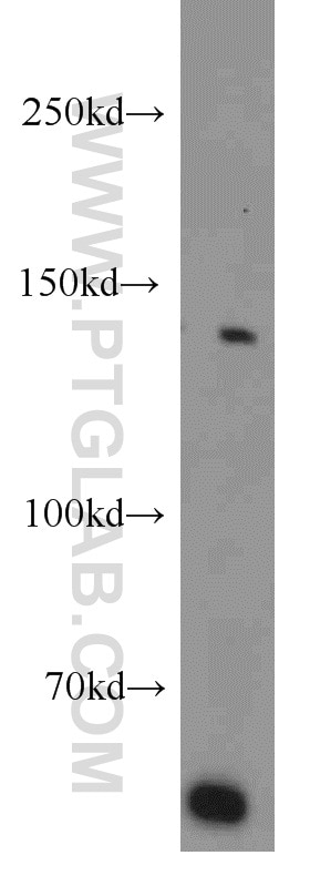 Western Blot (WB) analysis of mouse testis tissue using BubR1 Polyclonal antibody (11504-2-AP)