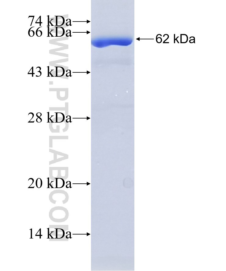 BUB1B fusion protein Ag2053 SDS-PAGE