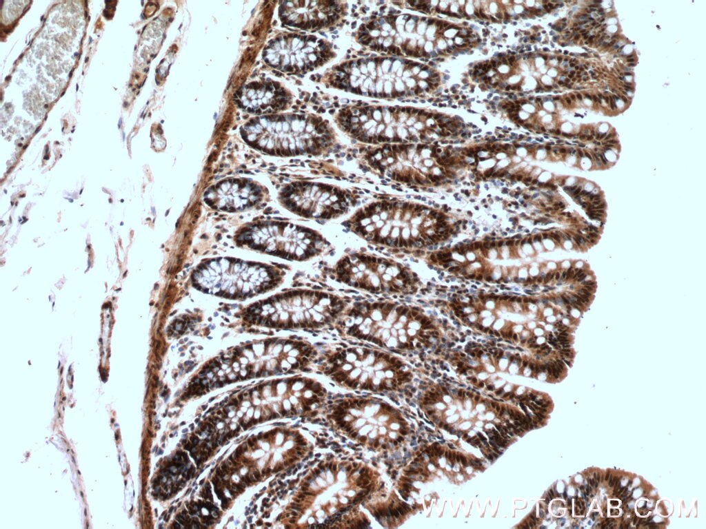 Immunohistochemistry (IHC) staining of human colon tissue using BUB3 Polyclonal antibody (27073-1-AP)