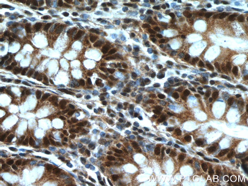 Immunohistochemistry (IHC) staining of human colon tissue using BUB3 Polyclonal antibody (27073-1-AP)