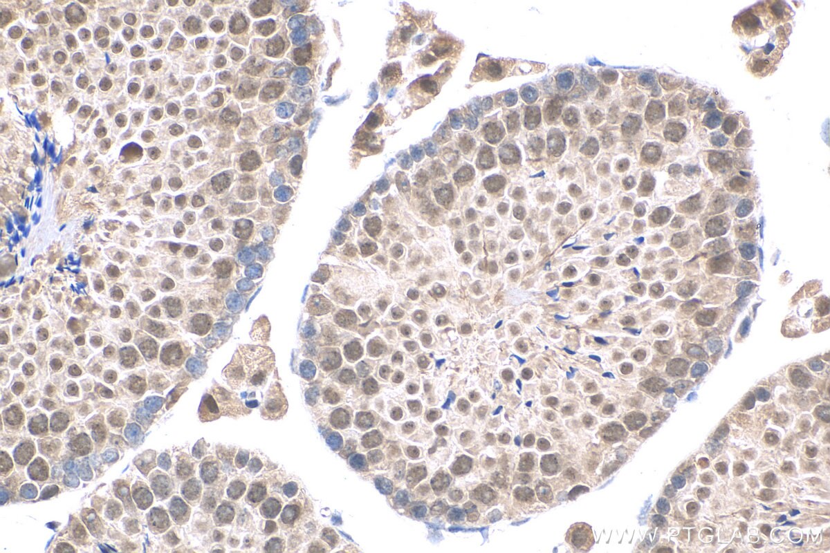 Immunohistochemistry (IHC) staining of mouse testis tissue using BUD13 Polyclonal antibody (20163-1-AP)